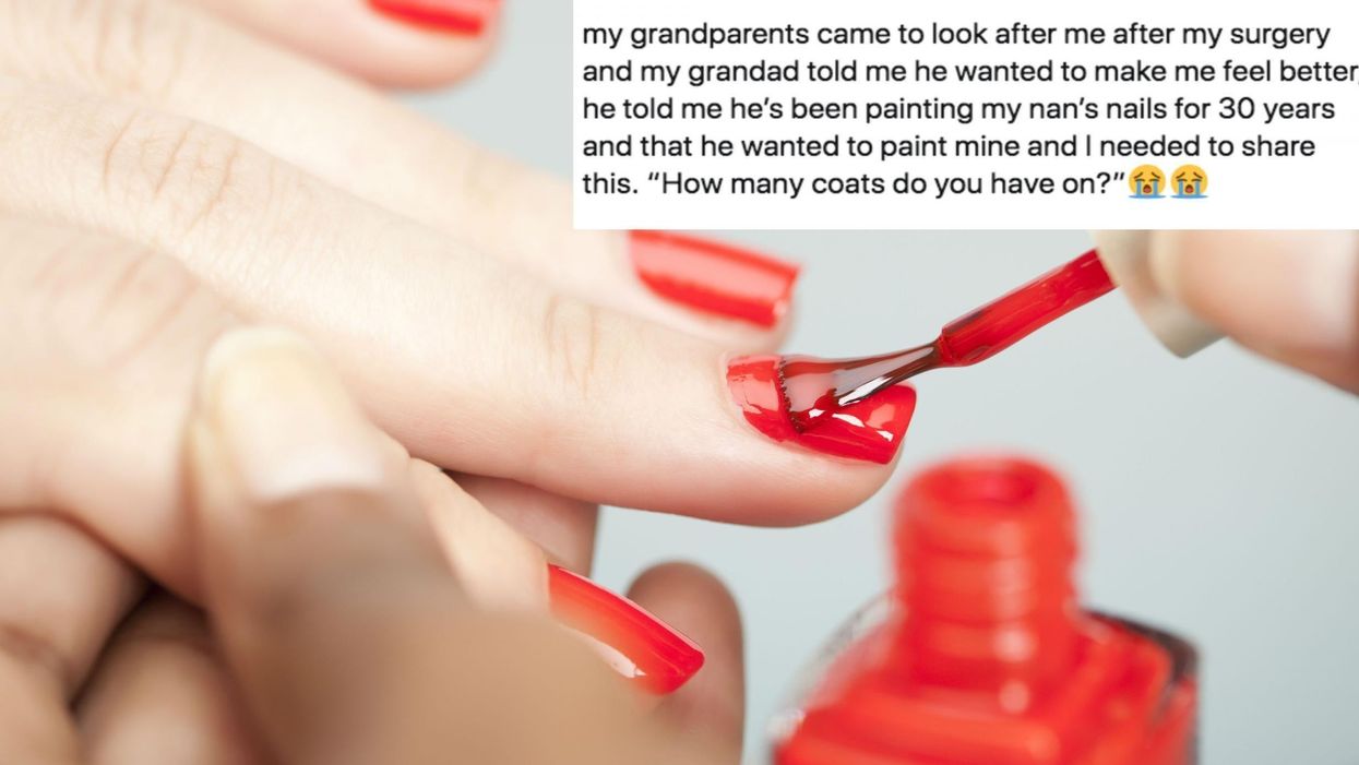 Grandpa gives granddaughter manicure after surgery in heartwarming video