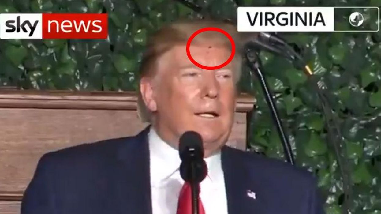 Donald Trump gave a speech with a bug crawling through his hair