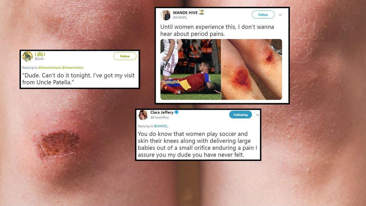 Man compares skinned knees to period pain. It didn’t go down well
