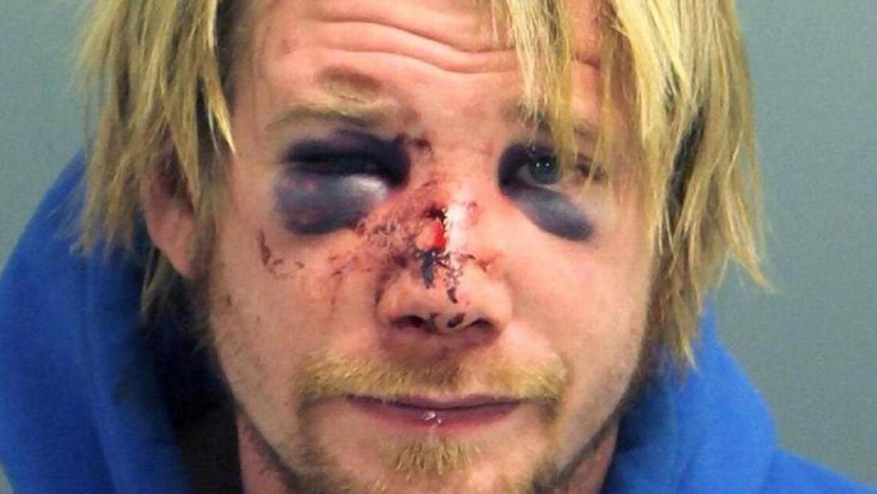 This is why you shouldn't break into houses