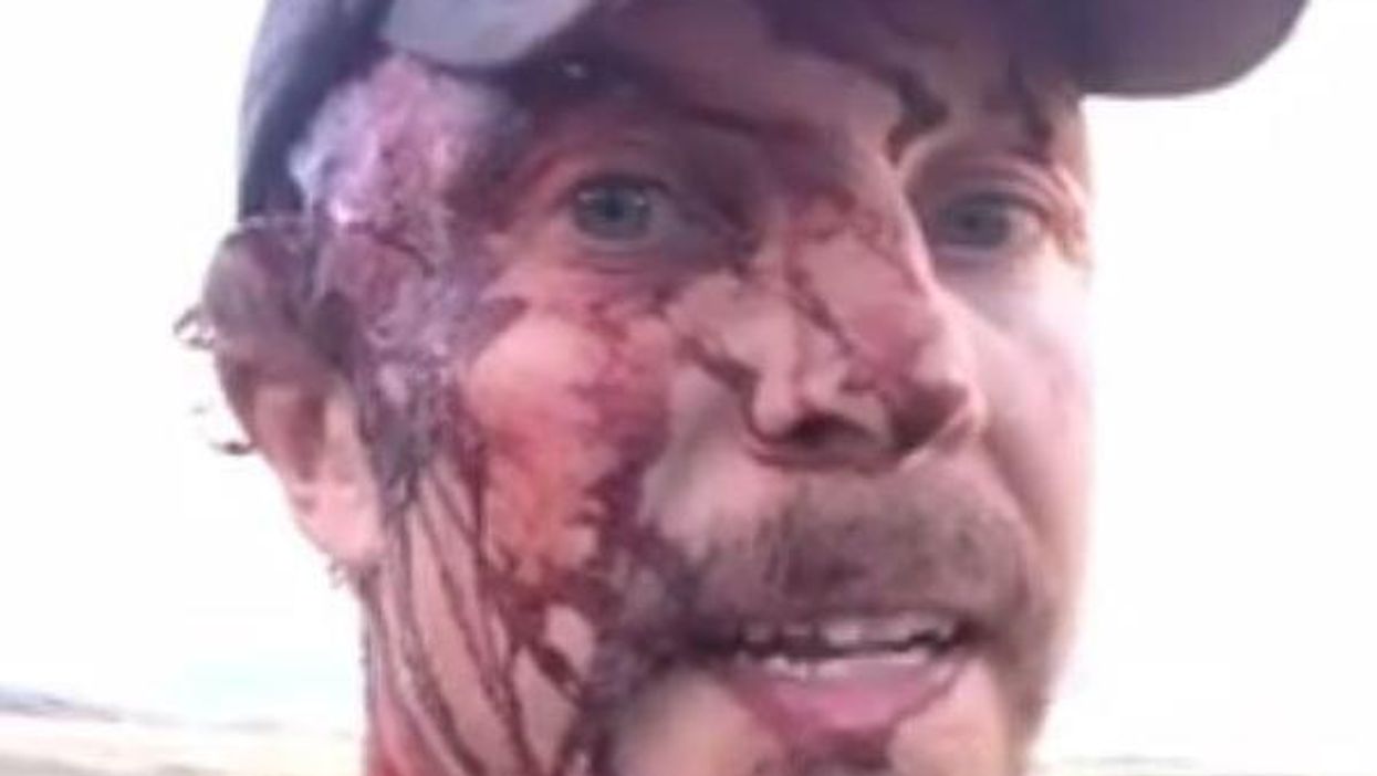 This man went into incredible detail about how he survived two bear attacks in an hour