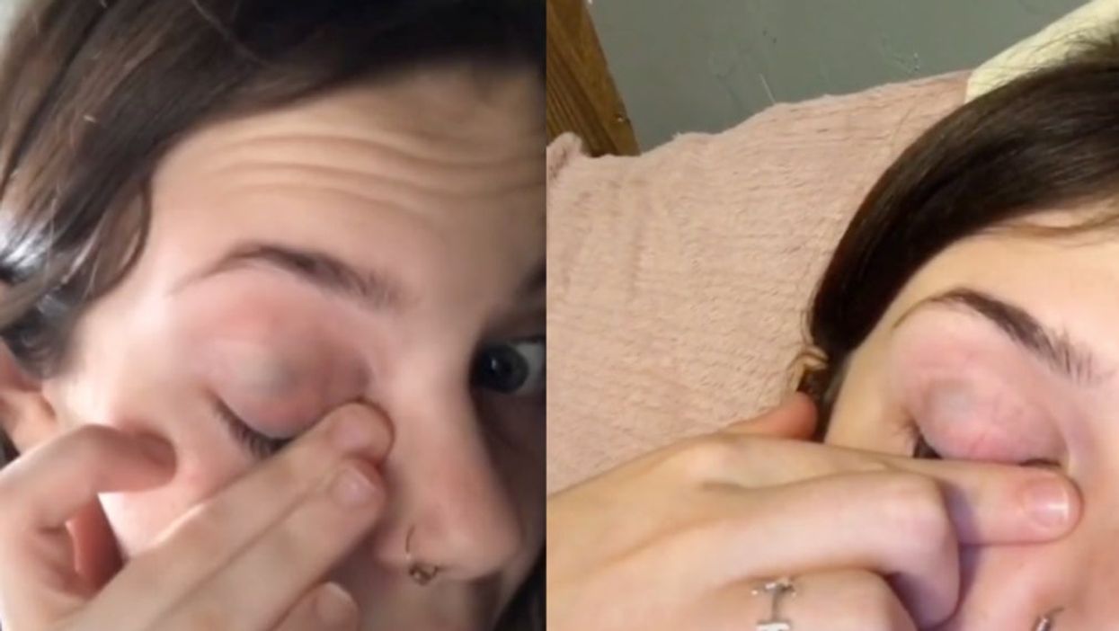 Freaky TikTok video shows girls eyeball moving around behind the eyelid