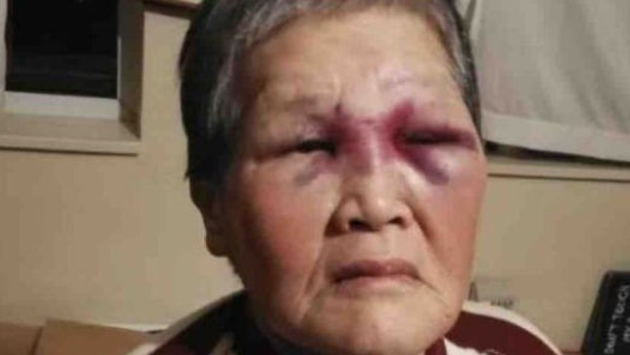Asian grandmother to donate more than $900k raised for her after attack to campaign against racism