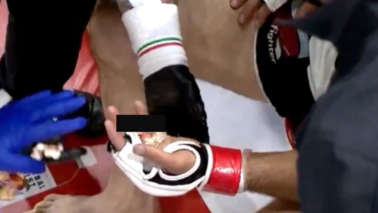 MMA fighter has finger kicked clean from his hand and doesn’t even notice