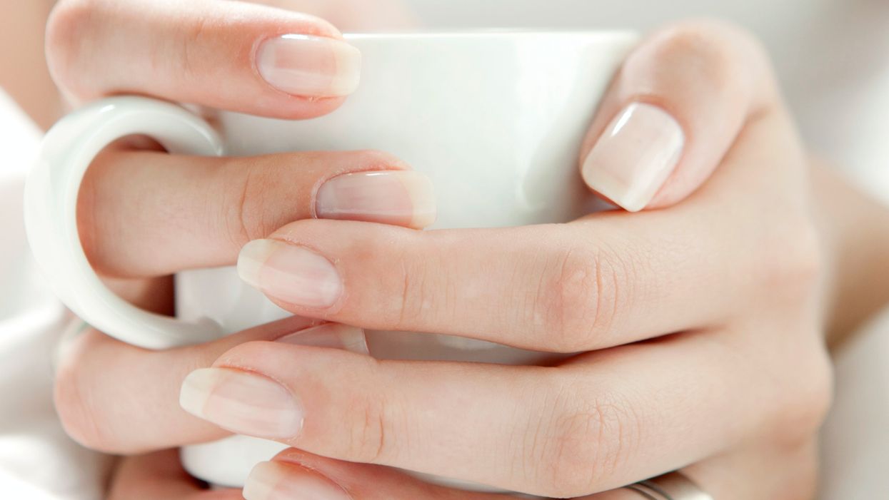 If your nails look like this it could mean you had coronavirus