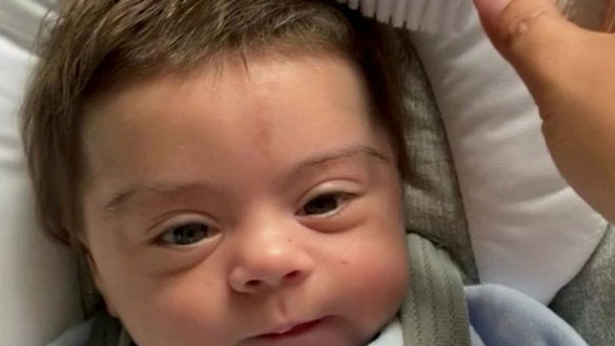 Baby boy born with thick brown hair becomes a social media star