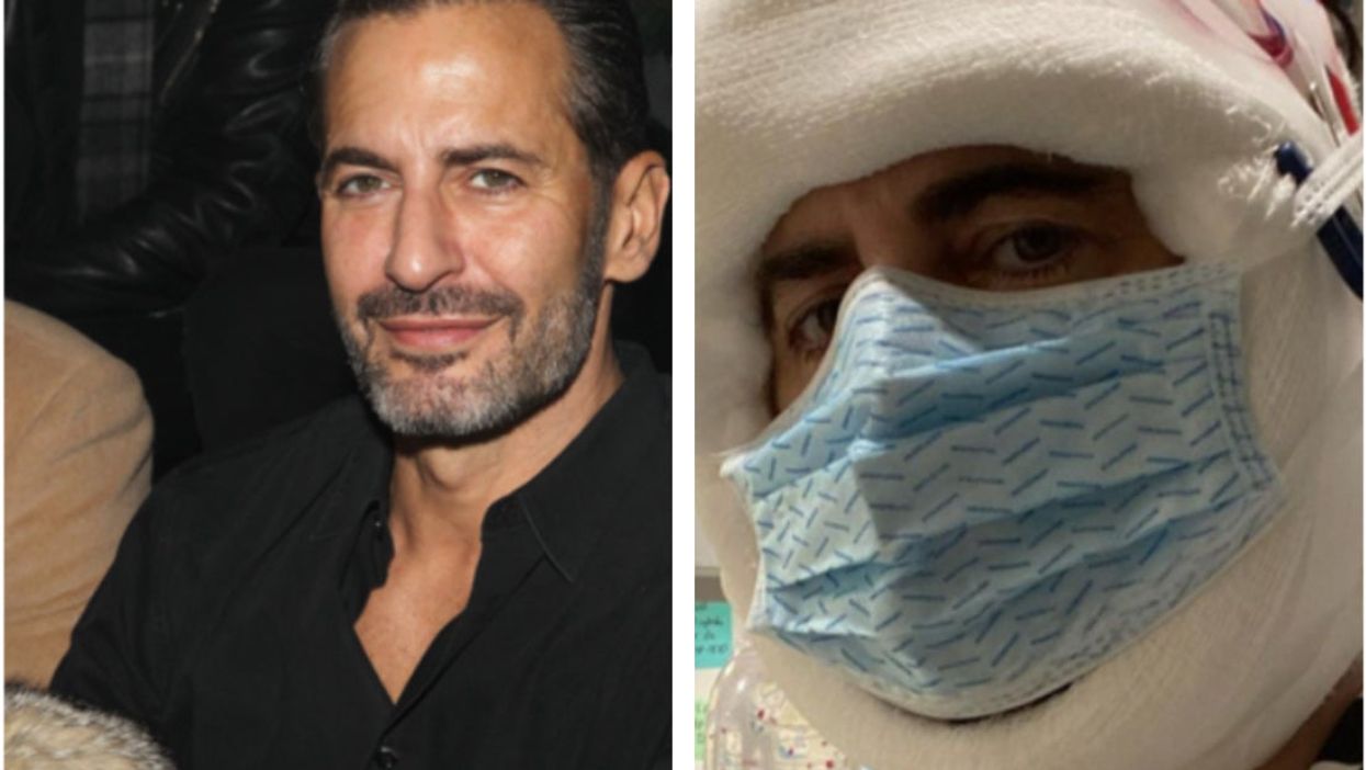 Designer Marc Jacobs announces he’s had a facelift by posting pic of heavily bandaged face to Instagram