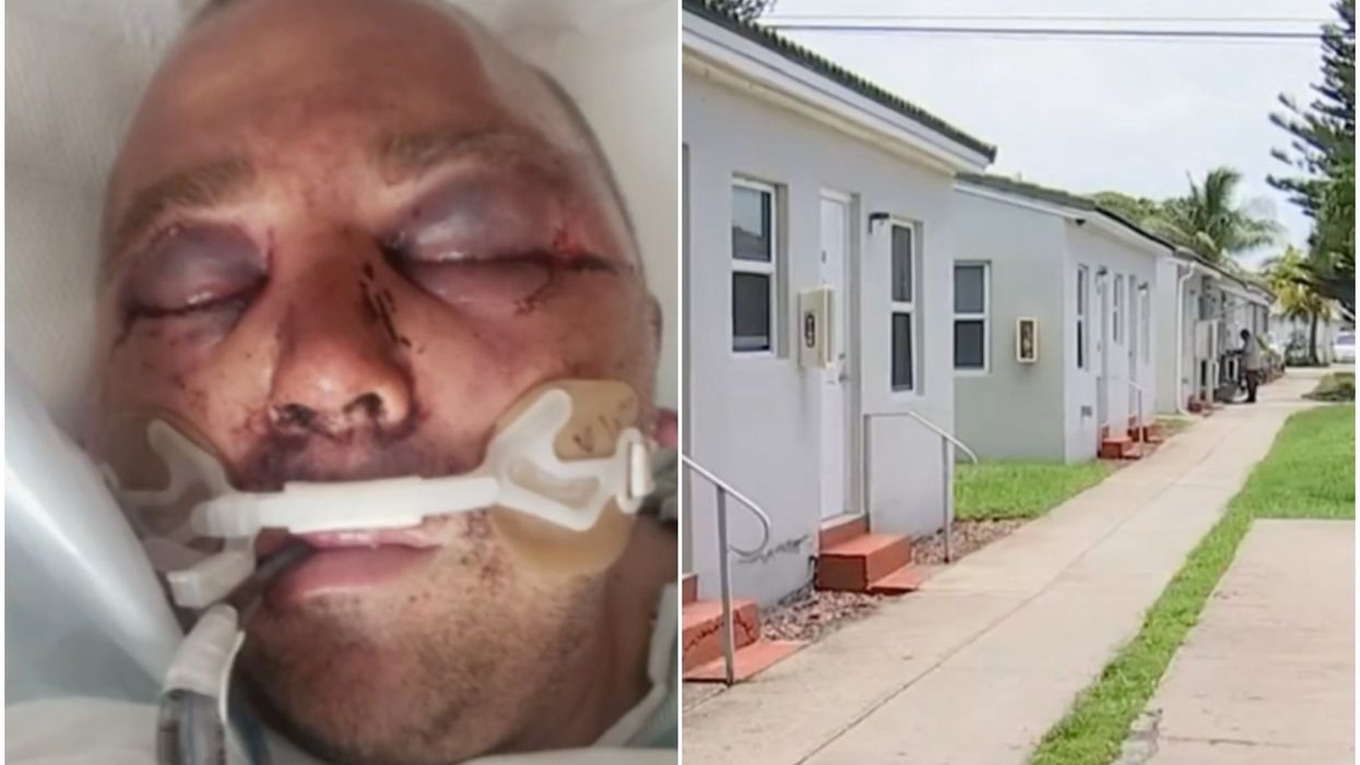 Man ‘beaten into a coma’ after asking neighbors to turn music down