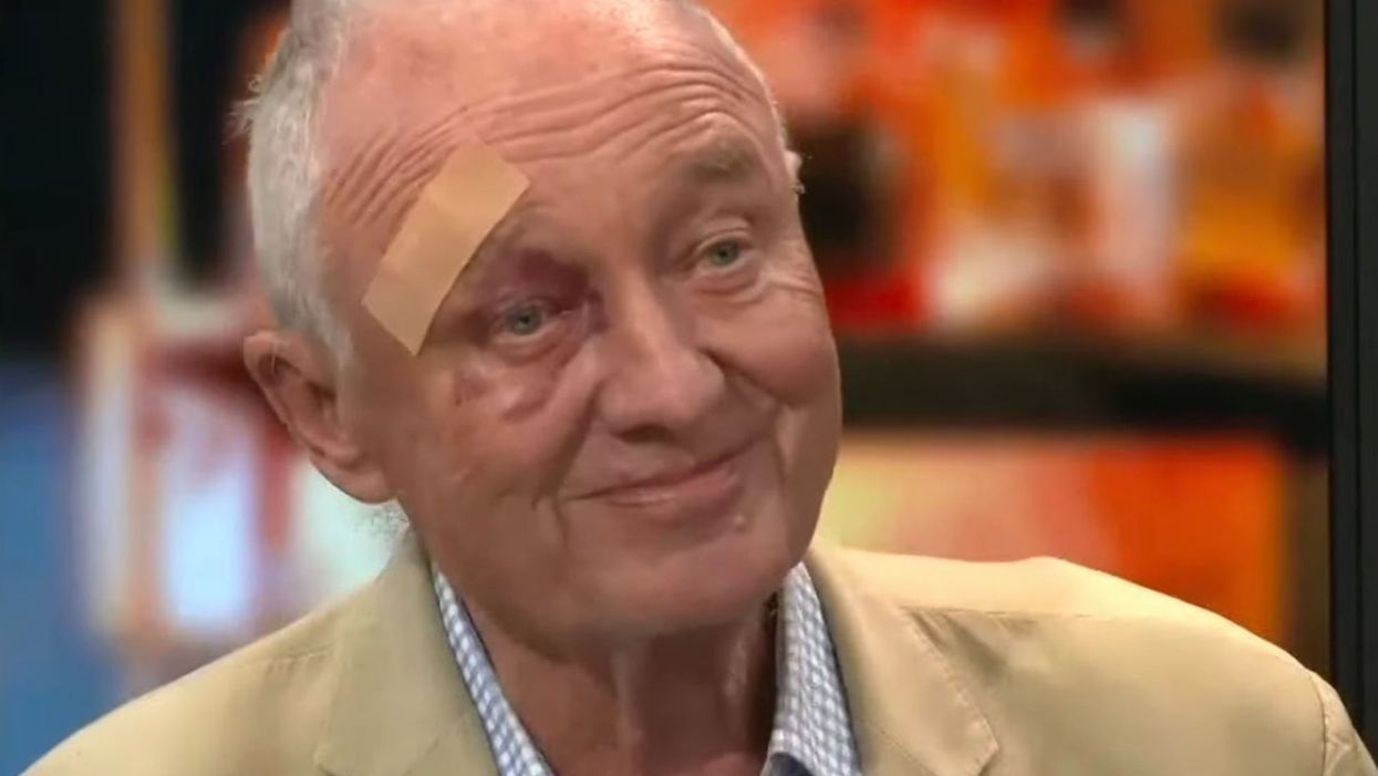 Viewers shocked after Ken Livingstone appears on GB News with facial injury: ‘What has happened to him?’
