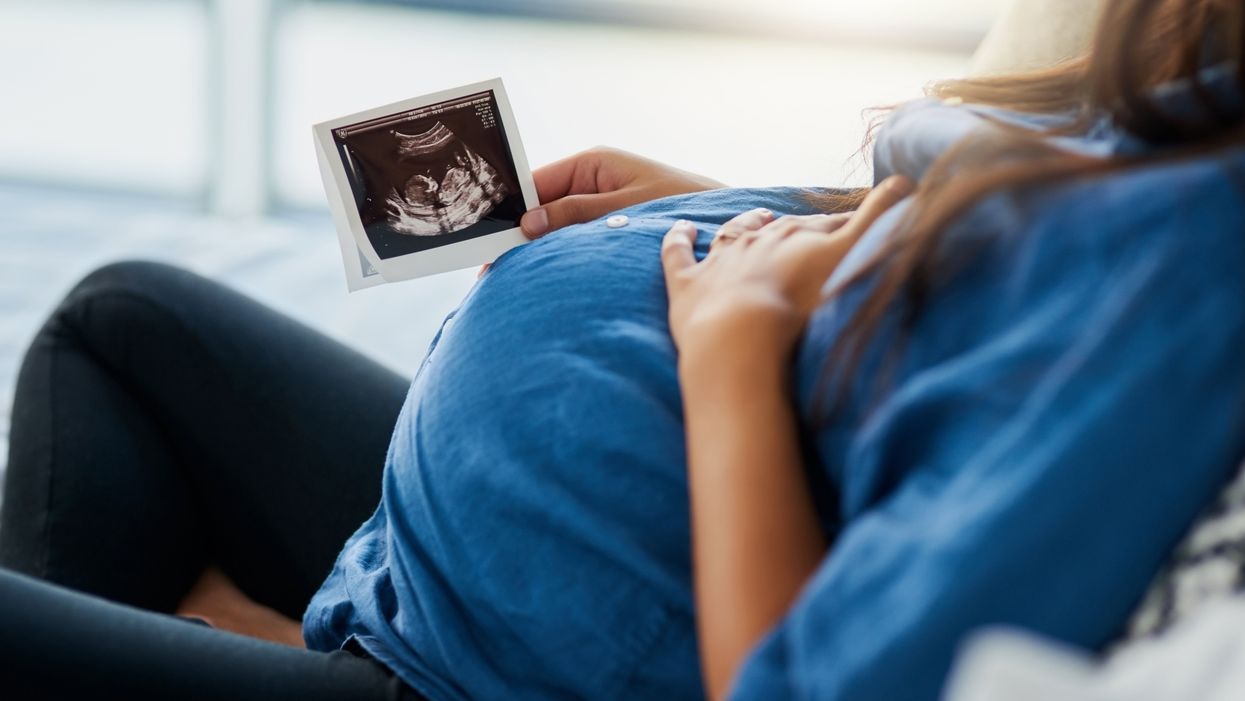 The pandemic is making women reconsider having babies