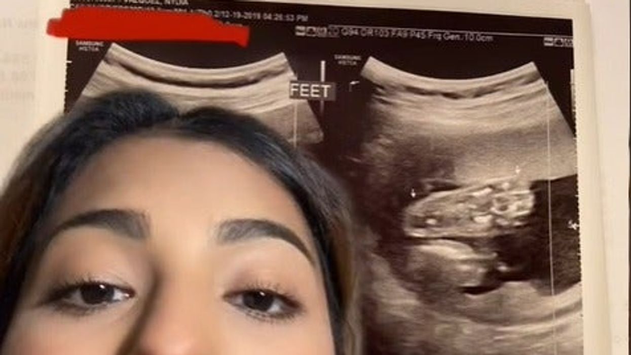 ‘He hid in there so well’: Woman didn’t know she was pregnant for six months