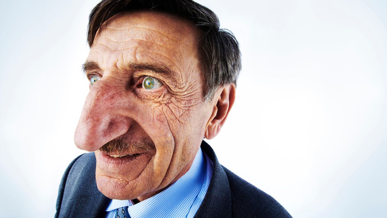 Meet the man with the largest nose in the world