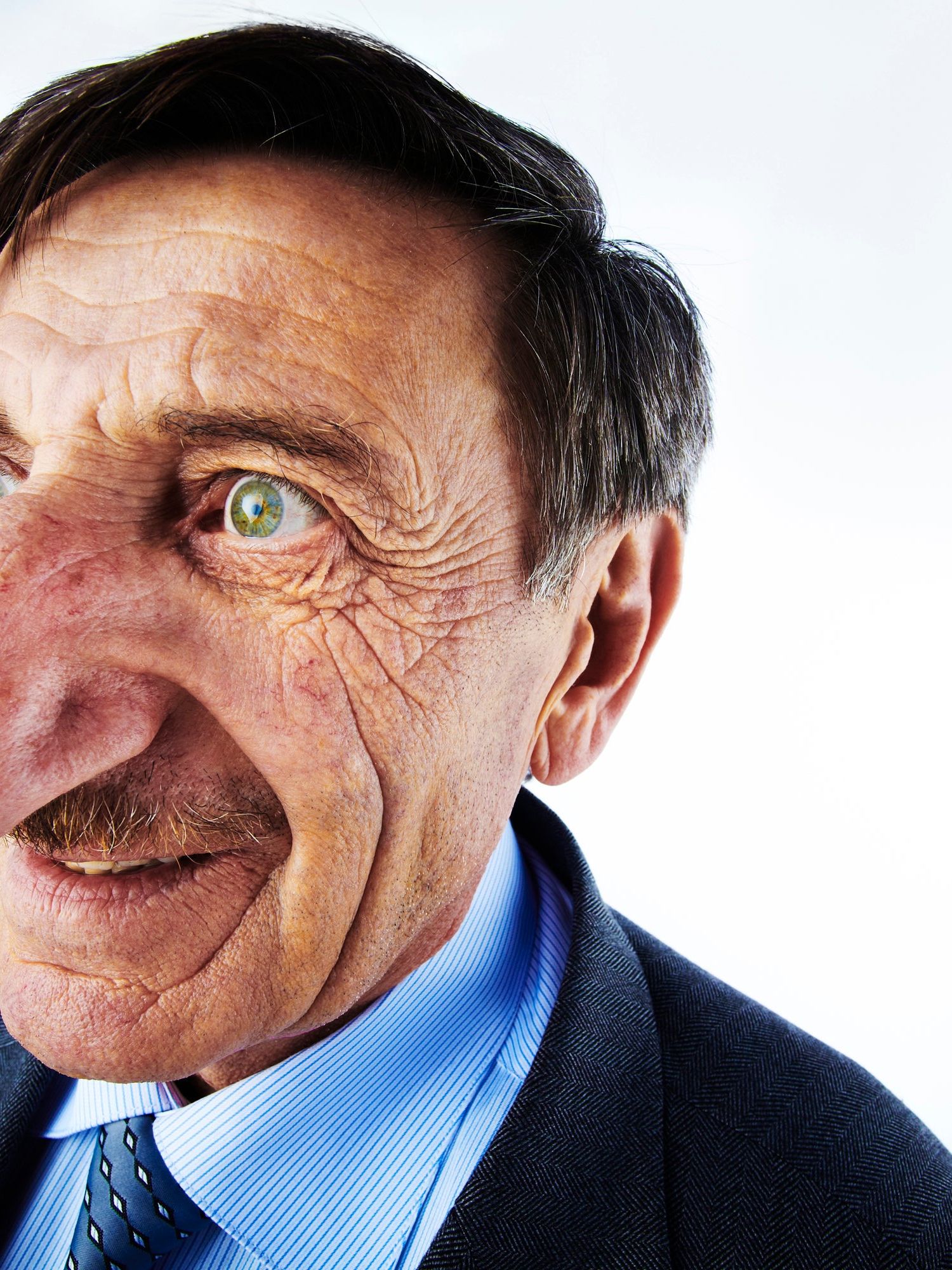 Meet the man with the largest nose in the world