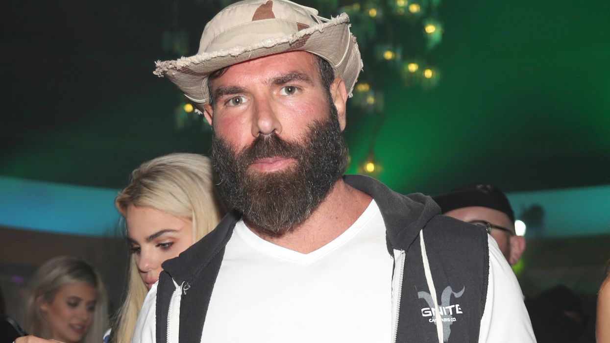 Dan Bilzerian says someone stole his $1m watch from his wrist during Alvarez fight