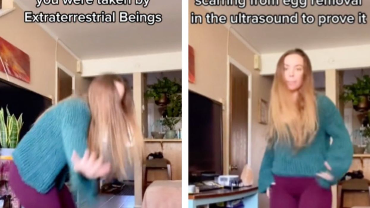 Woman tells TikTok she was abducted by aliens and has scarring to ‘prove it’