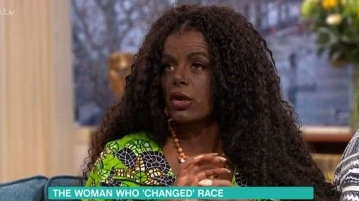 White woman who 'changed race' thinks she will be able to have a black baby with white husband