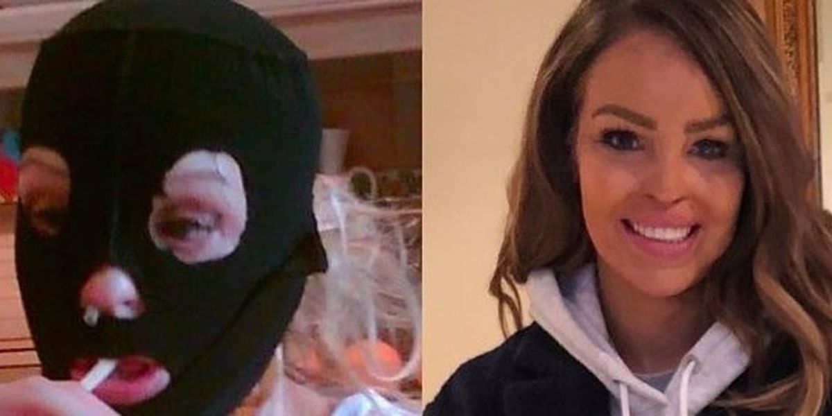 Acid attack victim Katie Piper shares inspiring '10 year challenge' post that puts everything in perspective | indy100 | indy100