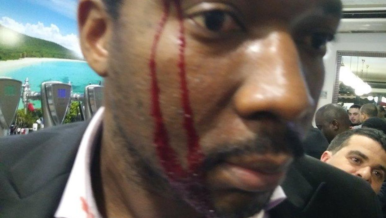 Woman accused of telling actor 'I'm white. I can kill you and nothing will happen' before bottle attack