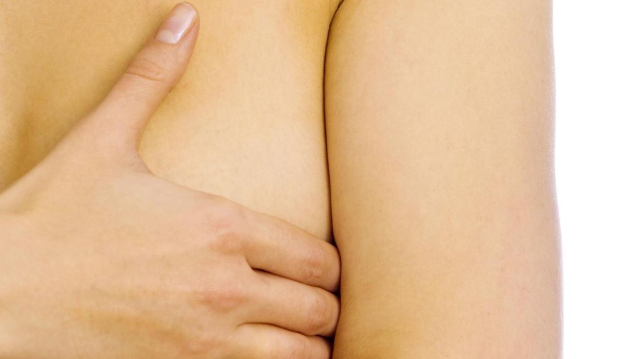 This photo shows an often overlooked symptom of cancer