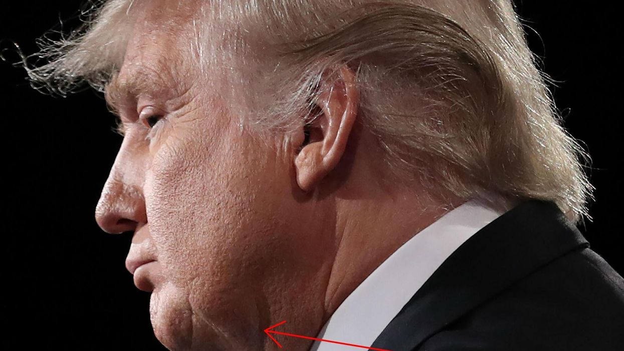 Donald Trump really wants you to stop sharing these photos of his double chin