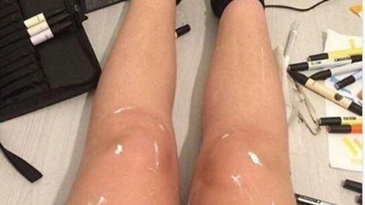 No one can decide if these legs are oily or have white paint on them
