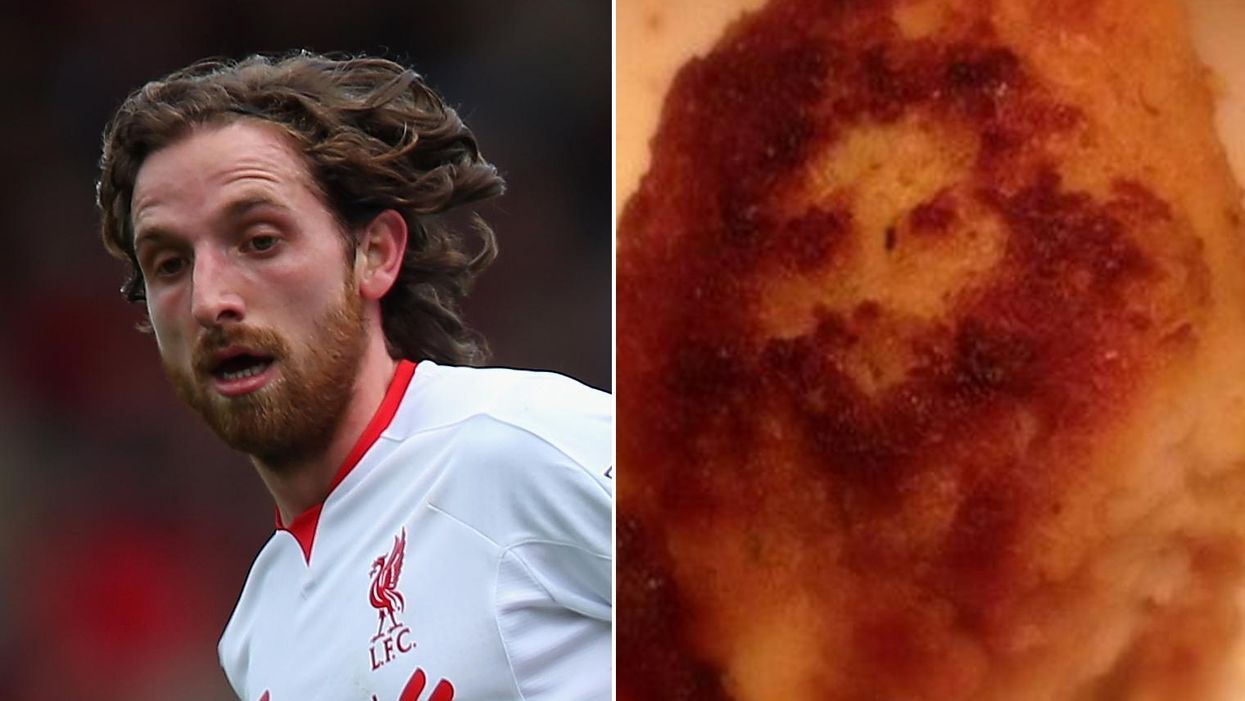 Is Liverpool midfielder Joe Allen hidden in this chicken nugget?