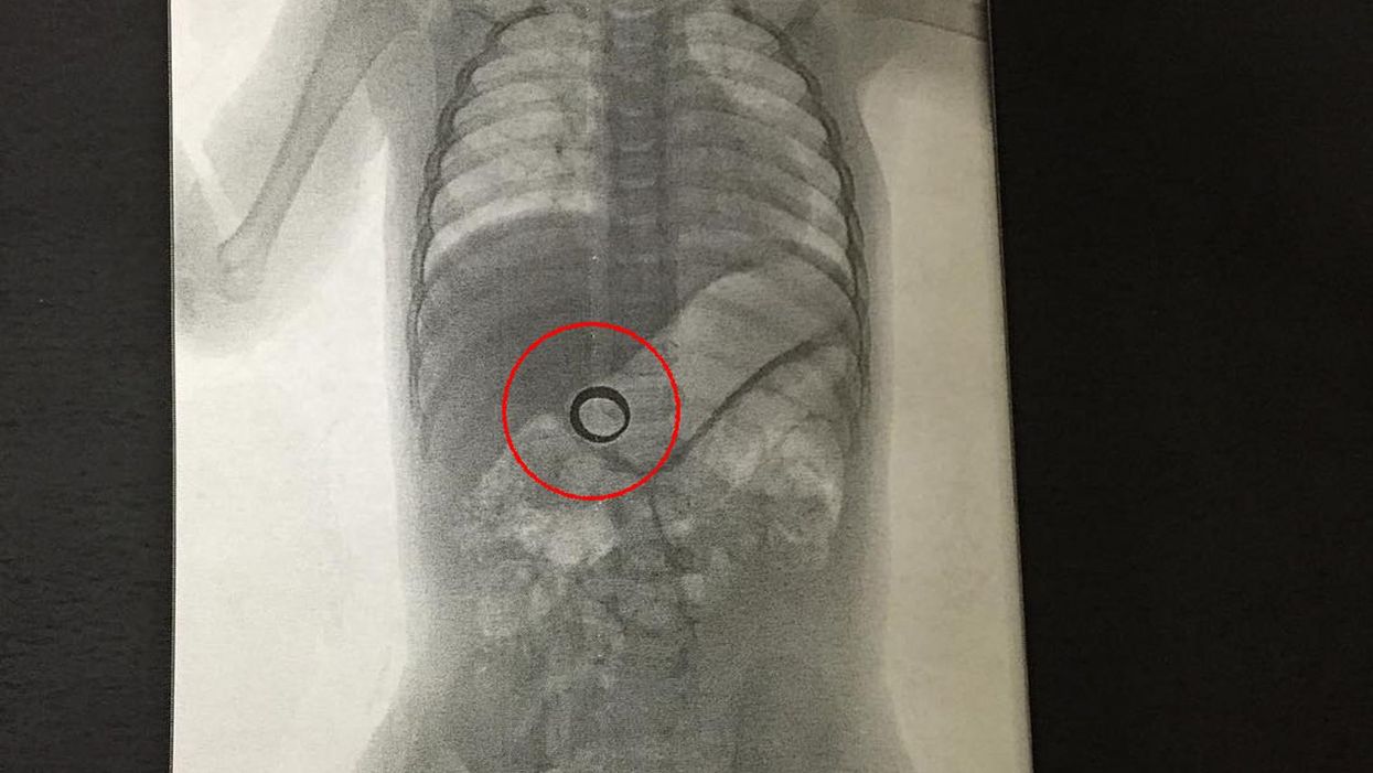 A couple lost their wedding ring and it turned up in the most unlikely of places