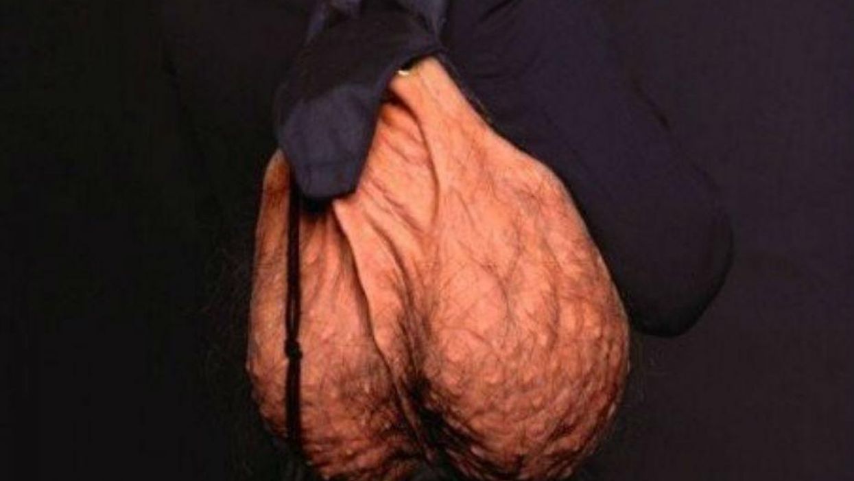 A man is crowdfunding so he can start making scrotum rucksacks