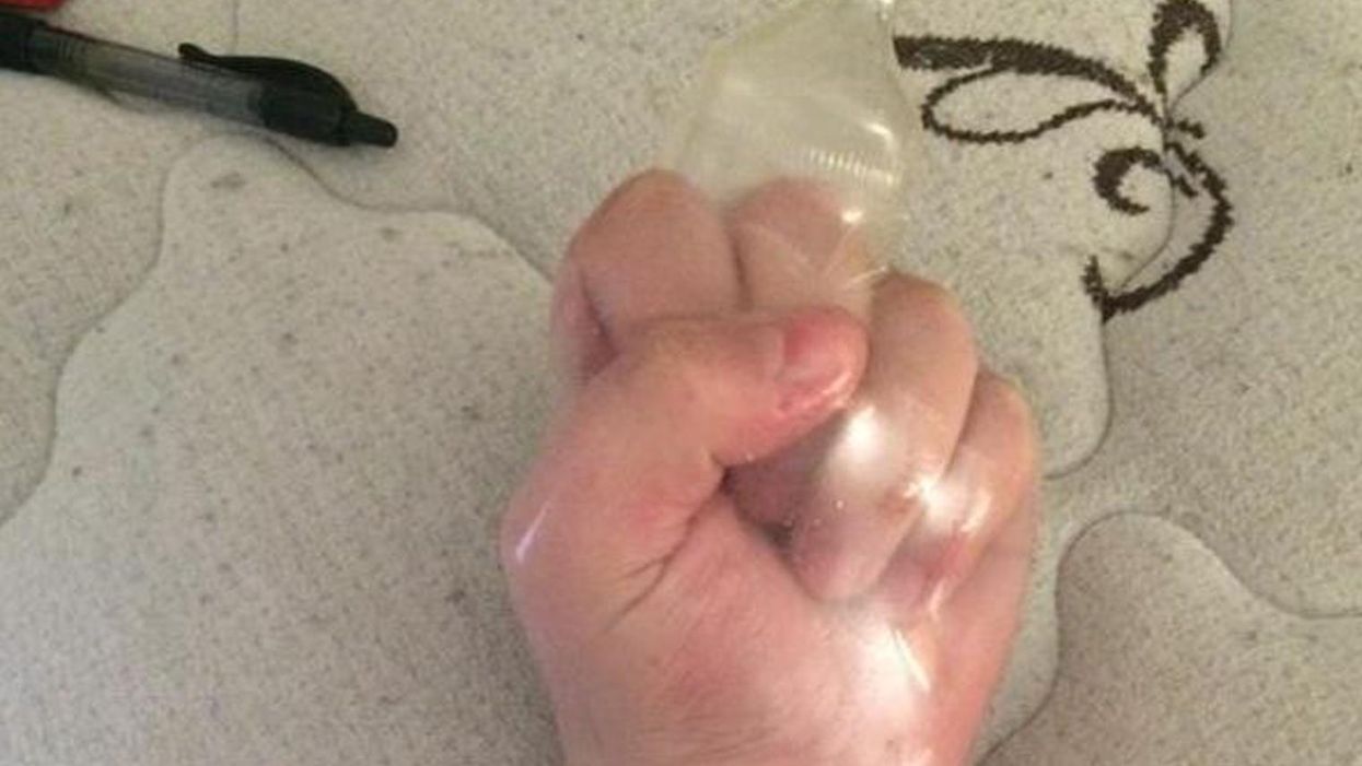This woman's picture of a condom on her arm has gone viral for all the right reasons