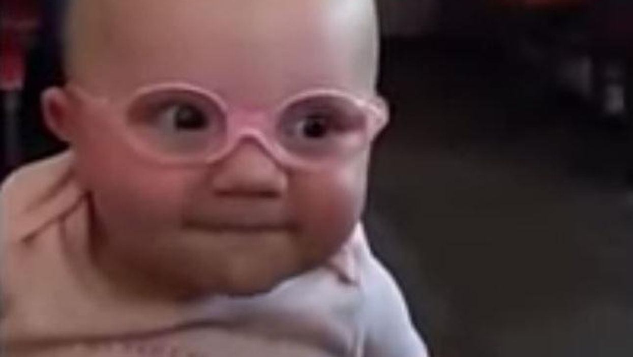 Cute baby with poor eyesight sees clearly for the first time