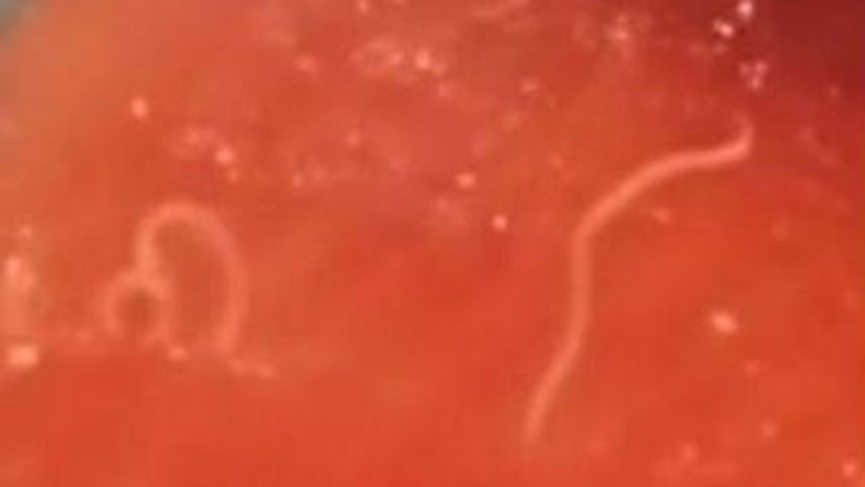 This woman filmed worms in her fresh fish and we want to stop the internet