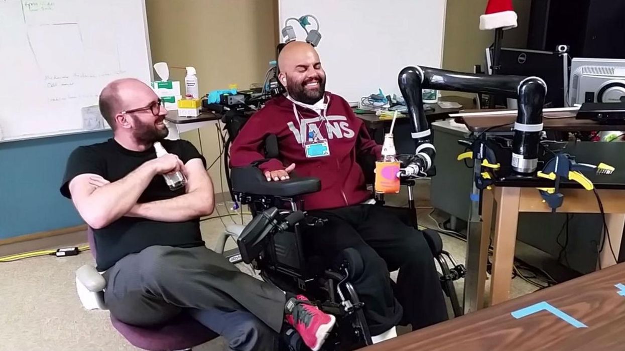 Man controls bionic arm with his brain, uses it to drink beer