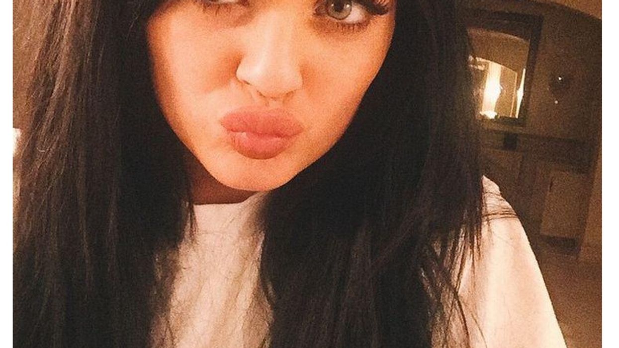 Teenagers are trying to recreate Kylie Jenner's lips using bottle tops and they need to stop immediately