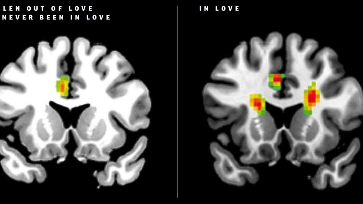 This is what happens to your brain when you fall in love