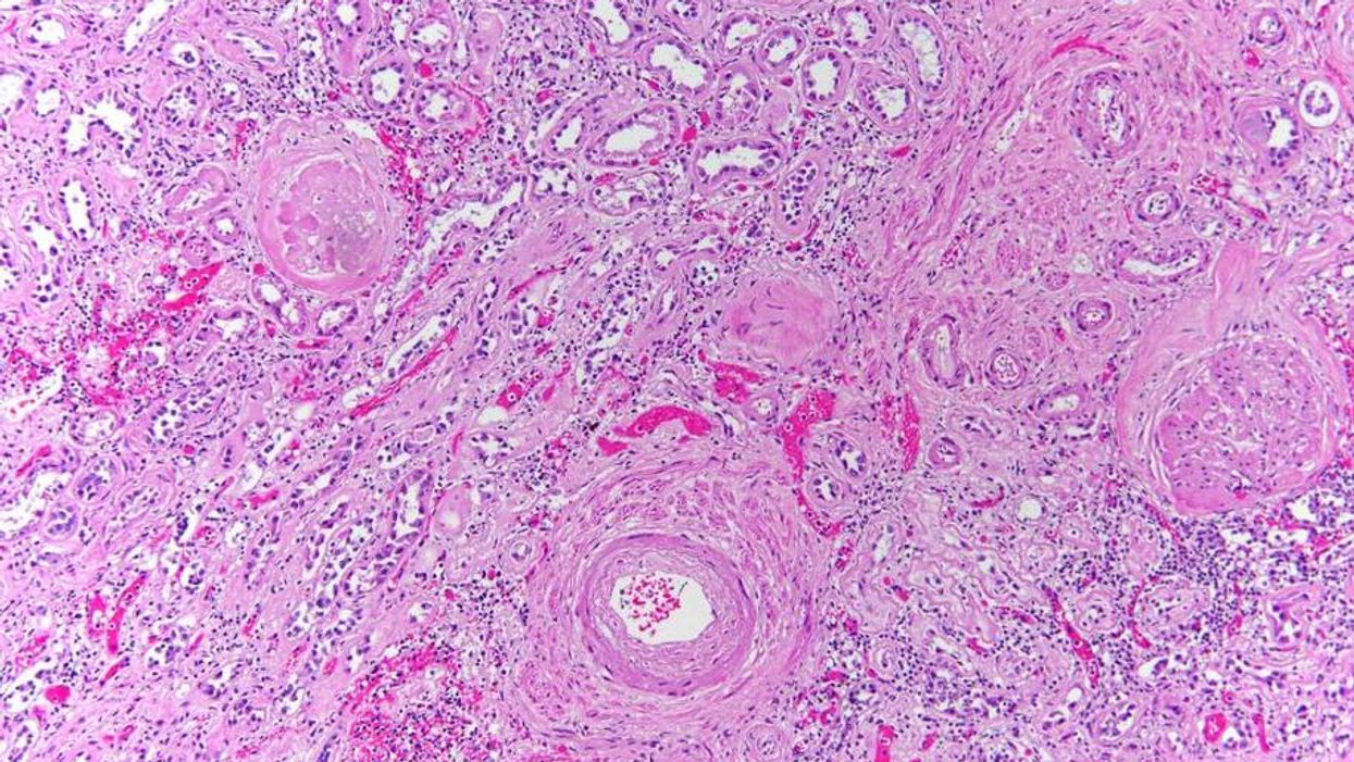 This is what death looks like under the microscope