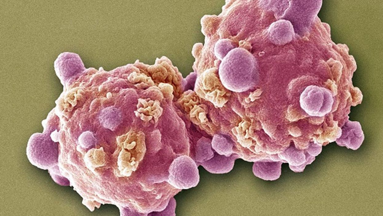 People are ignoring early warning signs of cancer. Here's what they are