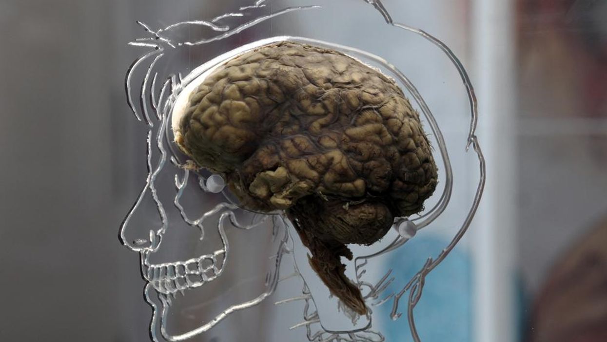 Your jerk brain can be convinced it committed a crime