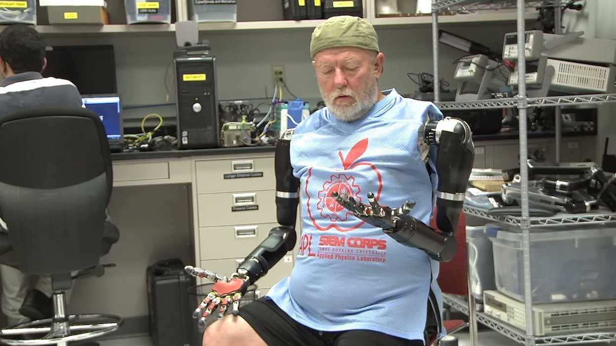 This double amputee has been given a quite incredible pair of limbs