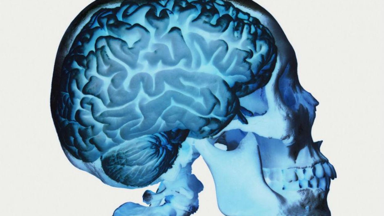 Scientists believe they have found a dementia 'weak spot' in the brain