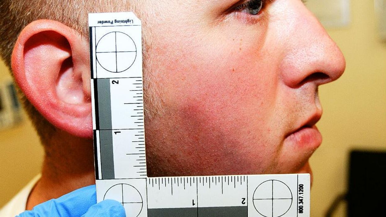 Photos showing extent of Darren Wilson's injuries released