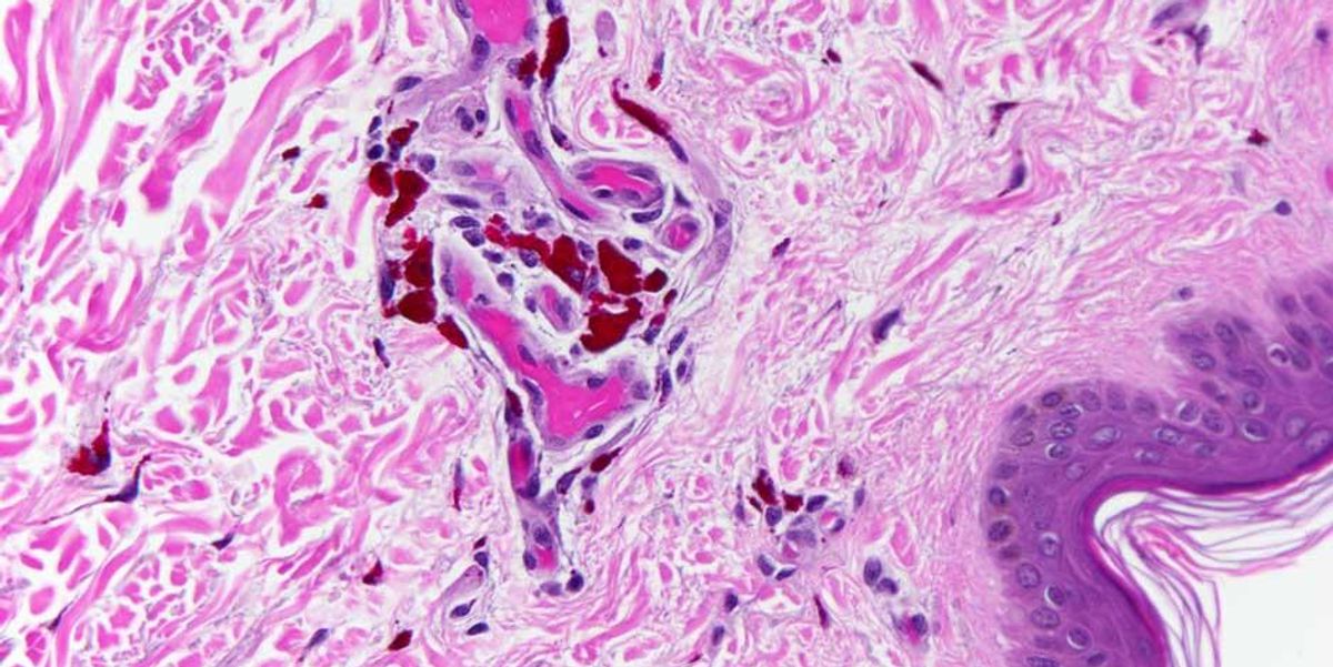 What death looks like under the microscope | indy100 | indy100