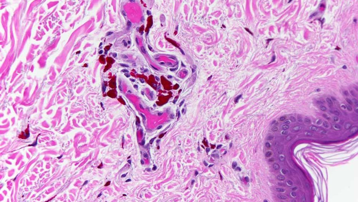 What death looks like under the microscope