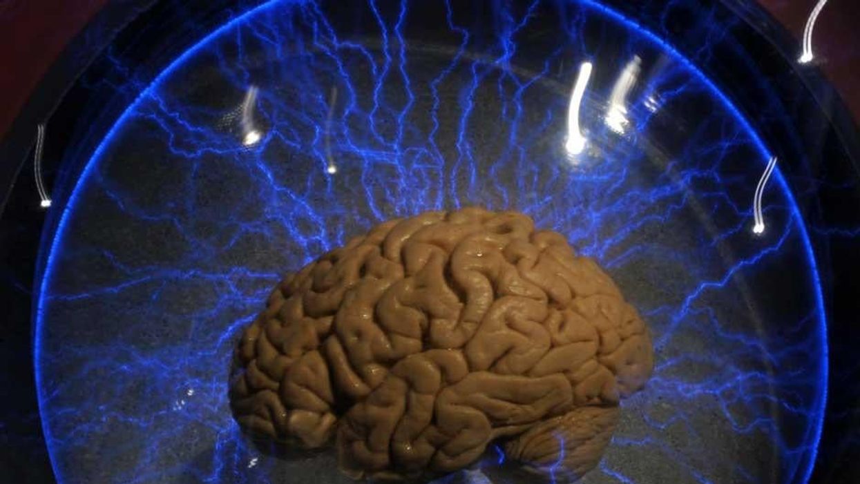 Quiz: What's your brain age?