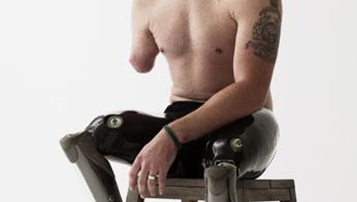 These 14 moving photos of wounded soldiers were all taken by Bryan Adams