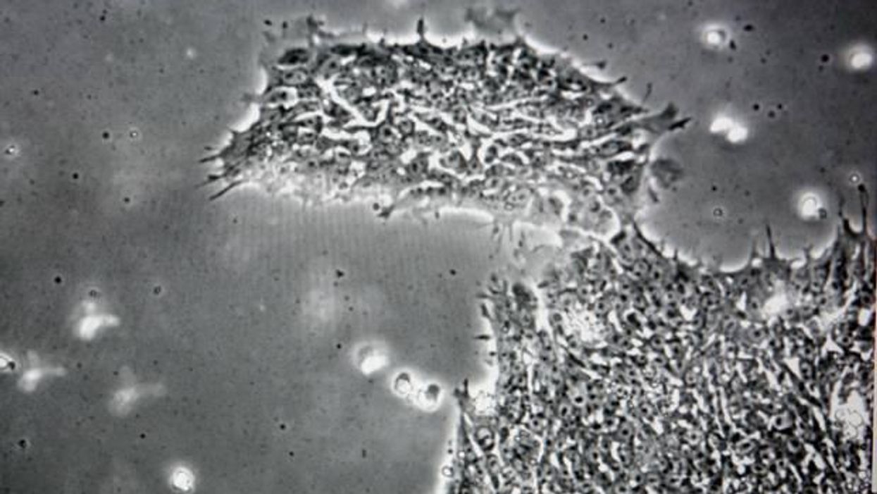 Scientists create cancer-killing stem cells