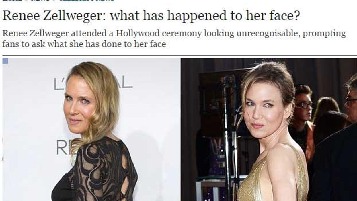 The facepalm that was coverage of Renee Zellweger's face