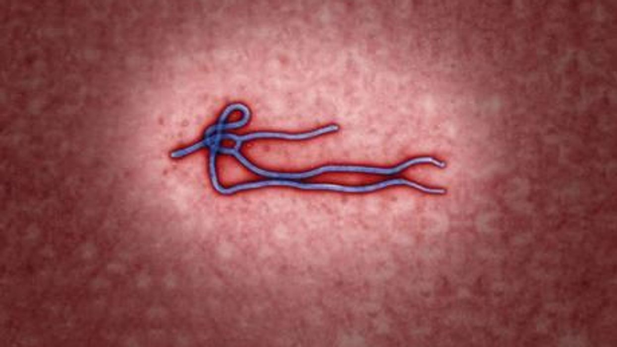 Why it's not time to panic about Ebola in Britain