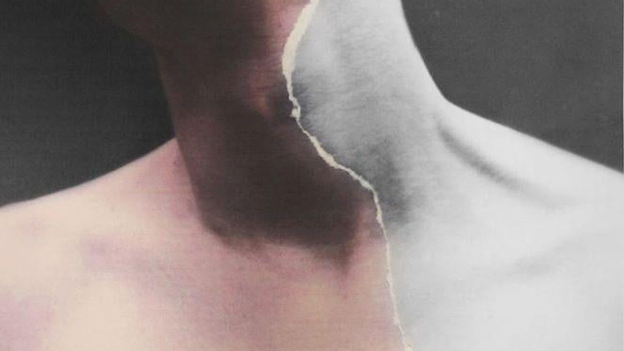 How an accident inspired these haunting mixed media photographs