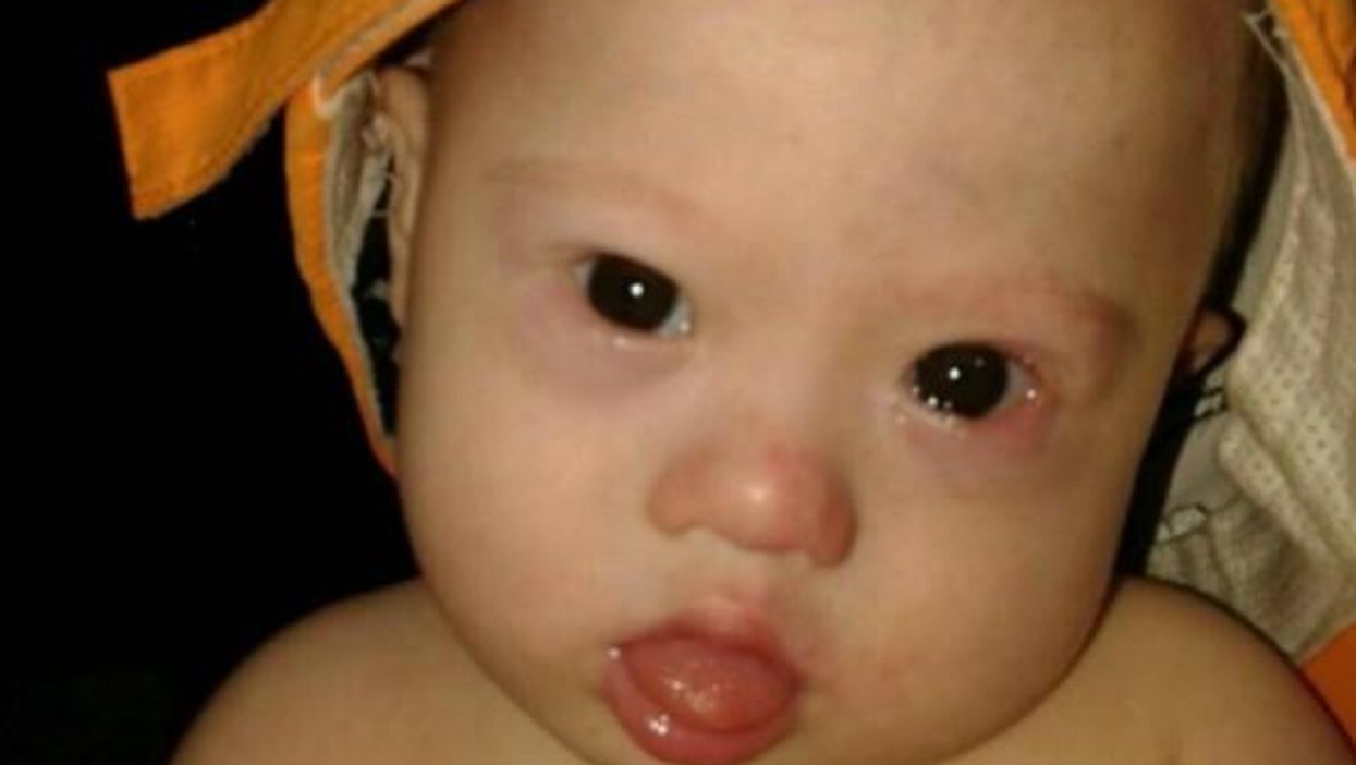 Thousands raised for abandoned Down Syndrome baby