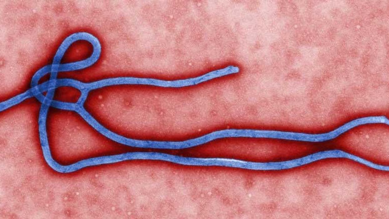 Six reasons why it's not time to panic about Ebola in the UK